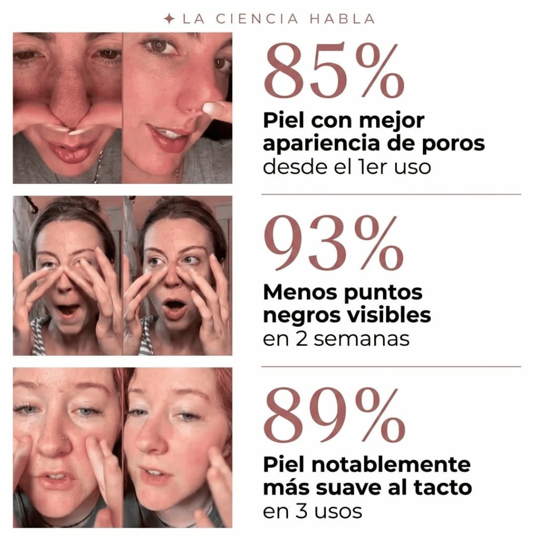 Peel Shot. Exfoliante Coreano de Arroz para Poros Visibles y Piel Apagada